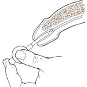 injection therapy